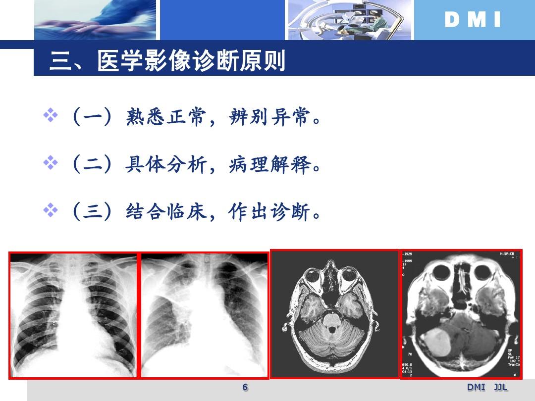 医学影像诊断，现代医学的透视眼力量