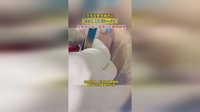 女婴哭闹不止背后的安全隐患，儿童日常护理的重要性与注意事项